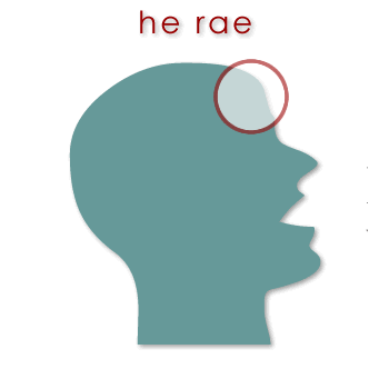00513 rae - forehead 01